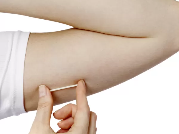 Implantes Hormonais 